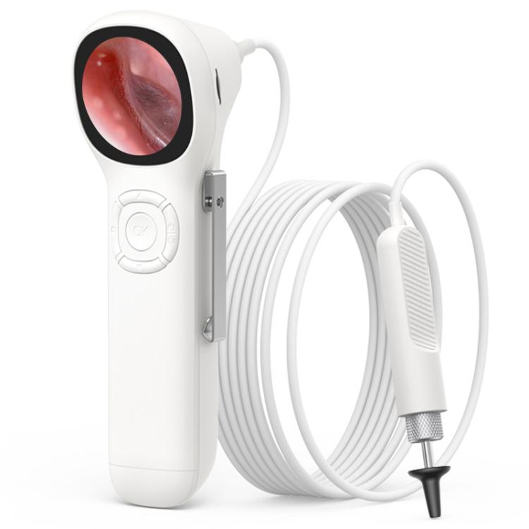 Otoscopio visual inteligente portátil TESLONG SA160 con pantalla HD de ...